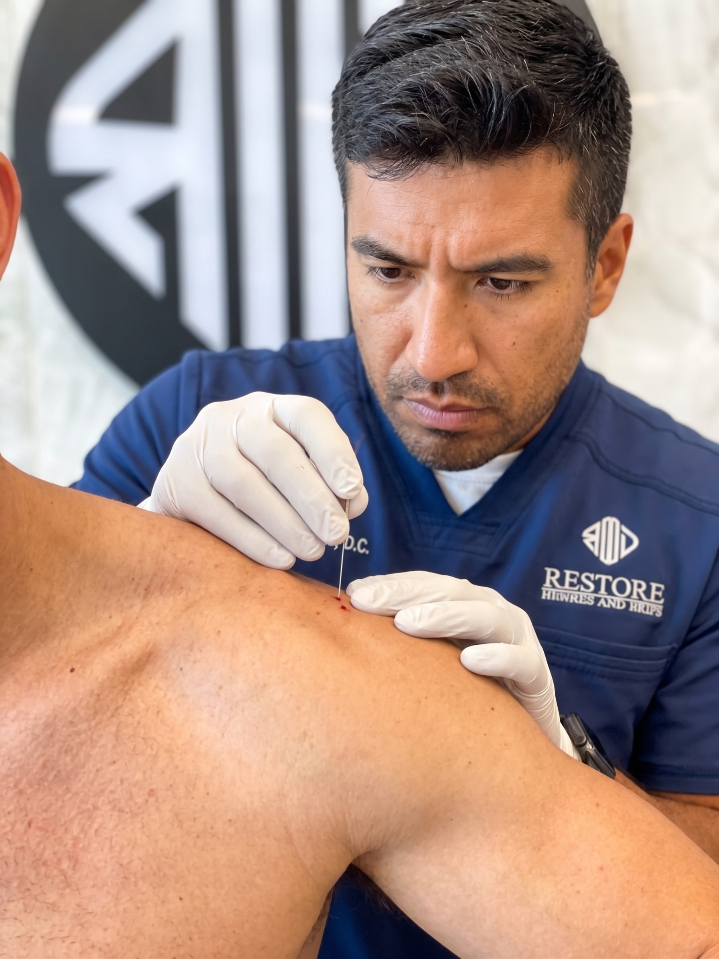 Dry Needling in Kansas City, MO
