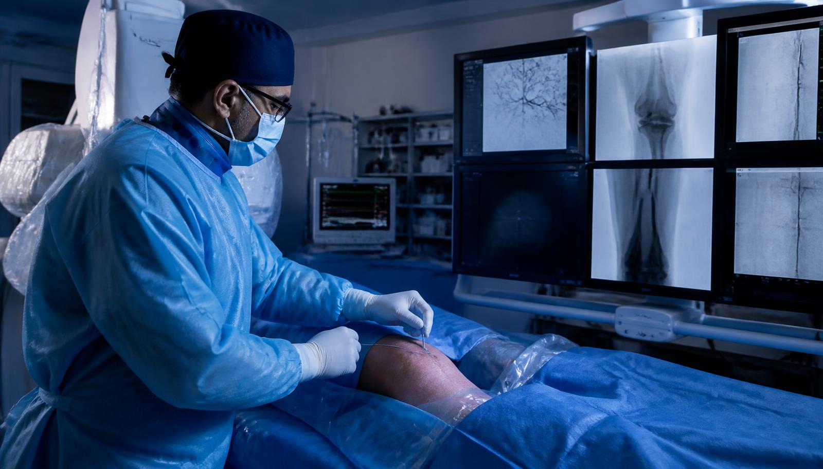 Still in Pain After a Knee Replacement? Genicular Artery Embolization Explained