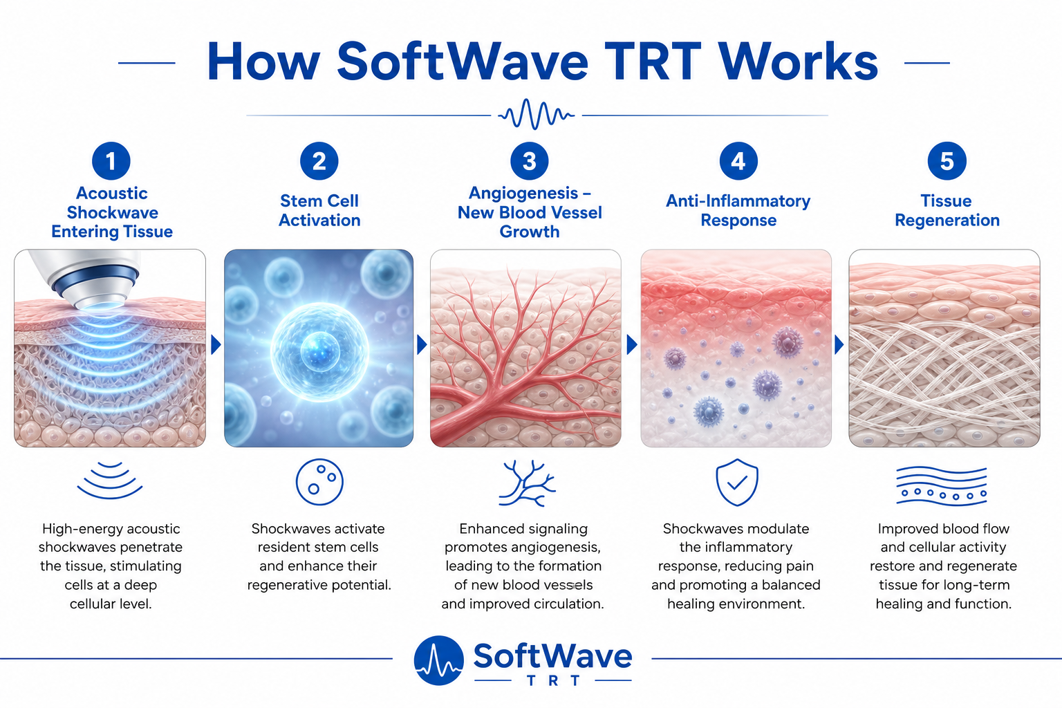 Infographic showing the 5 stages of how SoftWave TRT works: acoustic shockwave entering tissue, stem cell activation, angiogenesis, anti-inflammatory response, and tissue regeneration